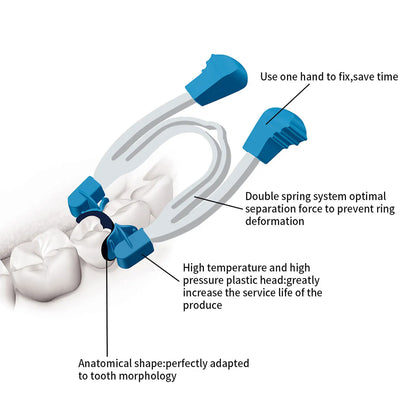 AZDENT Dental Sectional Contoured Matrix Clip Matrizen Klemmen Keile Zahnheilkunde Federclip Metallring Labor Hilfswerkzeuge